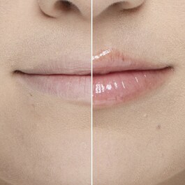 Lip Injection Extrême - Dudak Parlatıcısı