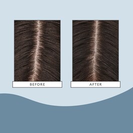 Scalp Revival