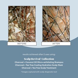 Scalp Revival Charcoal - Arındırıcı Şampuan