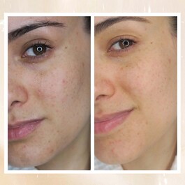 Radiance Overnight Glow Dark Spot Cream - Siyah Nokta Kremi