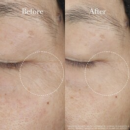 Tea Elixir Skin Resilience Activating Serum - Direnç Ve Esneklik Aktivatör Serum