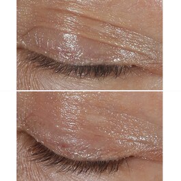Smart Clinical Repair™ - Kırışıklık Düzeltici Göz Kremi