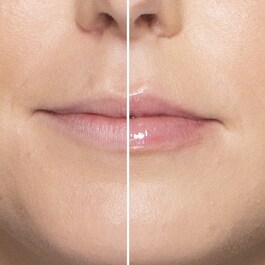 Lip Injection Extrême - Dudak Parlatıcısı