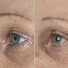 The Eye Cream Nomad - Göz Kremi