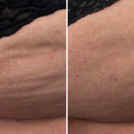 The Body Cream - Vücut Bakım