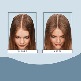 Scalp Revival