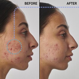 Scar, mark and wrinkle solution with 1% retinol - Yüz Serumu