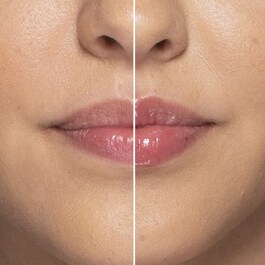 Lip Injection Extrême - Dudak Parlatıcısı