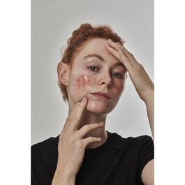 Redness Solution with 10% Azelaic - Yüz Serumu