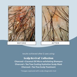Scalp Revival Charcoal - Arındırıcı Şampuan