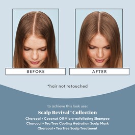 Scalp Revival Charcoal Treatment Serum