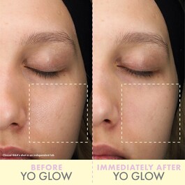 Yo Glow - Yüz peelingi 