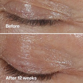 Smart Clinical Repair™ - Kırışıklık Düzeltici Göz Kremi