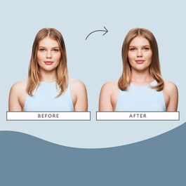 Scalp Revival