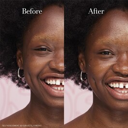 Rose Face Cream - Hyalüronik Asit İçeren Nemlendirici Yüz Kremi