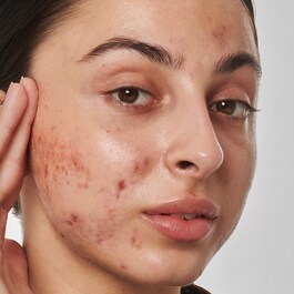Scar, mark and wrinkle solution with 1% retinol - Yüz Serumu