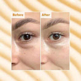 Radiance Brightening Dark Circle Eye Cream - Göz Kremi