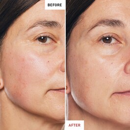Skin Therapy  - Multi-Perfecting Gece Yağı