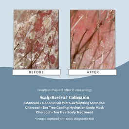 Scalp Revival Charcoal - Arındırıcı Şampuan