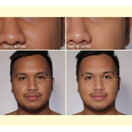 YO GLOW ENZYME MINI SCRUB - Seyahat Boy Peeling