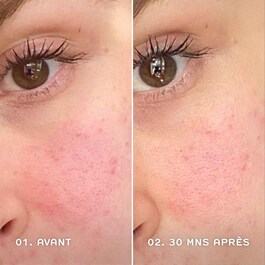 Evercalm™ - Yatıştırıcı Serum