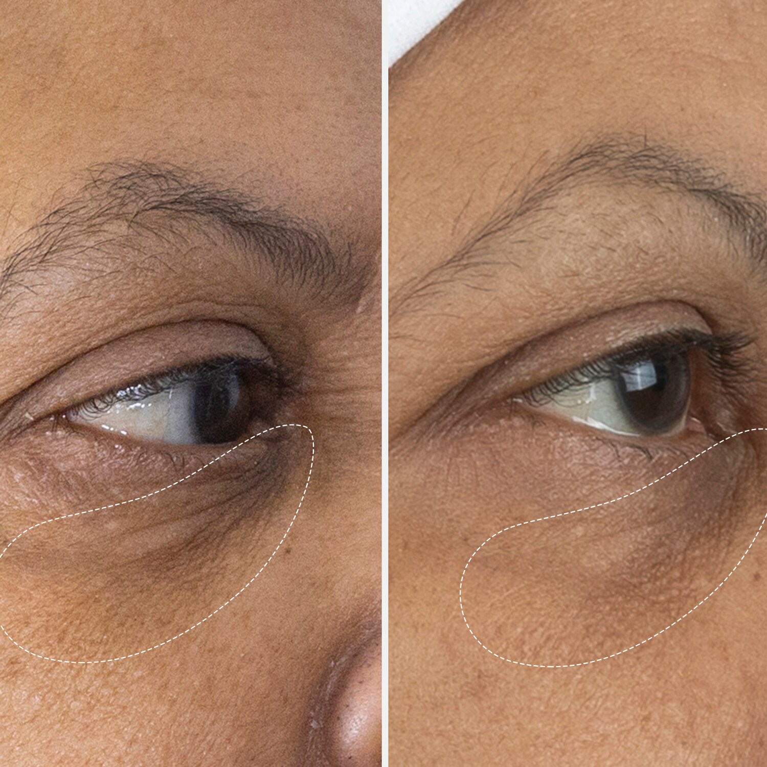 The Eye Cream Nomad Göz Kremi AUGUSTINUS BADER ≡ SEPHORA